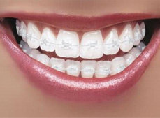 El mejor presupuesto de ortodoncia lo encontrars en nuestra clnica dental Virginia Salvador